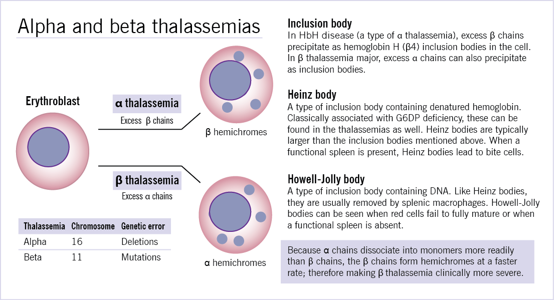Thalassemia Mcmaster Pathophysiology Review